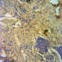 19 - Anti-PDK1 Antibody AP59655