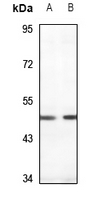 1 - Anti-PDK1 Antibody AP59655