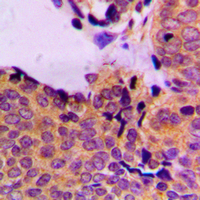 19 - Anti-PDPK1 (Phospho-S241) Antibody AP59656