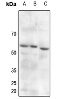1 - Anti-PDPK1 (Phospho-S241) Antibody AP59656
