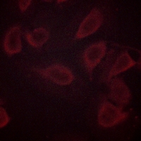 3 - Anti-CD31 (Phospho-Y713) Antibody AP59657