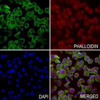 3 - Anti-Pepsinogen C Antibody AP59659