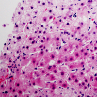 19 - Anti-Pepsinogen C Antibody AP59659