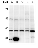 1 - Anti-Pepsinogen C Antibody AP59659
