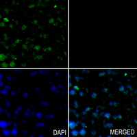 19 - Anti-Progesterone Receptor (Phospho-S294) Antibody AP59660