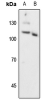 1 - Anti-Progesterone Receptor (Phospho-S294) Antibody AP59660