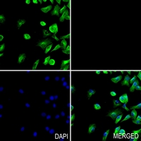 3 - Anti-PHKG1 Antibody AP59661
