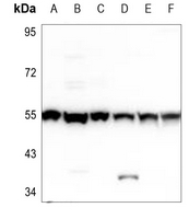 1 - Anti-PHKG1 Antibody AP59661