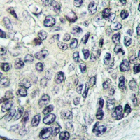 19 - Anti-PI3K C2 gamma Antibody AP59662