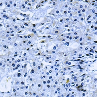 19 - Anti-PI3K p110 delta Antibody AP59663