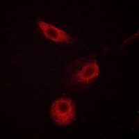 3 - Anti-PLC gamma 2 (Phospho-Y1217) Antibody AP59665