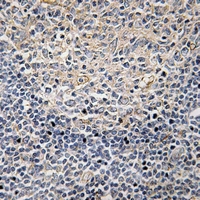 19 - Anti-PLC gamma 2 (Phospho-Y1217) Antibody AP59665