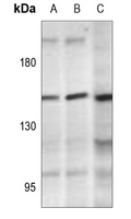 1 - Anti-PLC gamma 2 (Phospho-Y1217) Antibody AP59665