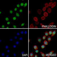 3 - Anti-PPAR gamma (Phospho-S112) Antibody AP59666