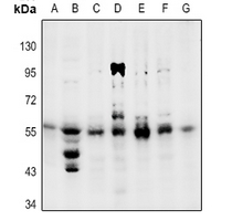 1 - Anti-PPAR gamma (Phospho-S112) Antibody AP59666
