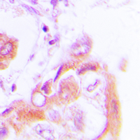 19 - Anti-AMPK beta 1 (Phospho-S182) Antibody AP59667