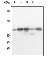 1 - Anti-AMPK beta 1 (Phospho-S182) Antibody AP59667