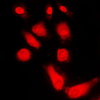 3 - Anti-PKA C alpha/beta/gamma Antibody AP59668