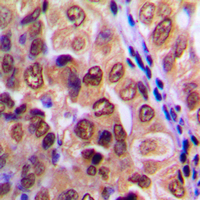 19 - Anti-PKA C alpha/beta/gamma Antibody AP59668