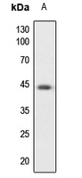 1 - Anti-PKA C alpha/beta/gamma Antibody AP59668