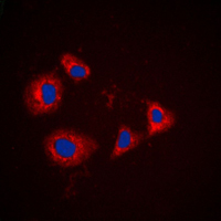 3 - Anti-PRKAR1A Antibody AP59669