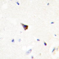 19 - Anti-PRKAR1A Antibody AP59669