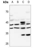 1 - Anti-PRKAR1A Antibody AP59669