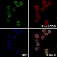 3 - Anti-PRKAR1B Antibody AP59670