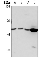 1 - Anti-PRKAR1B Antibody AP59670