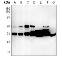 0 - Anti-PRKAR1B Antibody AP59670