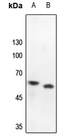 1 - Anti-PRKAR2B Antibody AP59671