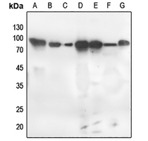 1 - Anti-PKC zeta (Phospho-T560) Antibody AP59672