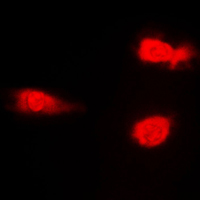 3 - Anti-JNK1/2/3 (Phospho-T183) Antibody AP59673