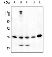 1 - Anti-JNK1/2/3 (Phospho-T183) Antibody AP59673