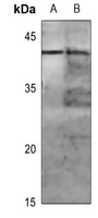 1 - Anti-MKK1 (Phospho-T286) Antibody AP59674