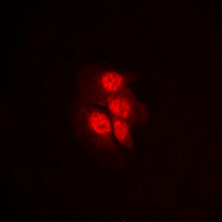 3 - Anti-MKK1 (Phospho-T292) Antibody AP59675