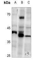 1 - Anti-PRKX Antibody AP59676