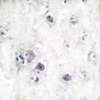 19 - Anti-Peripherin Antibody AP59677