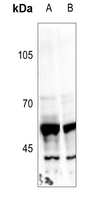 1 - Anti-Peripherin Antibody AP59677