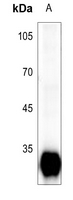 1 - Anti-Trypsin 3 Antibody AP59679