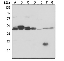1 - Anti-PSMC6 Antibody AP59680