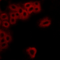 3 - Anti-EP4 Antibody AP59681