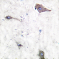 19 - Anti-PGHS-1 Antibody AP59682