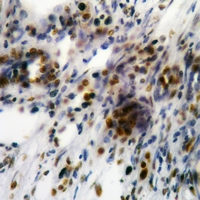 19 - Anti-Focal Adhesion Kinase (Phospho-Y861) Antibody AP59683