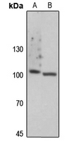 1 - Anti-Focal Adhesion Kinase (Phospho-Y861) Antibody AP59683
