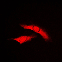 3 - Anti-RAD23B Antibody AP59684