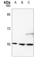 1 - Anti-RAD23B Antibody AP59684