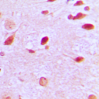 19 - Anti-RAP1GAP Antibody AP59685
