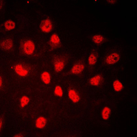 3 - Anti-RB1 (Phospho-S780) Antibody AP59686