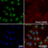 3 - Anti-NF-kappaB p65 (Phospho-S276) Antibody AP59688